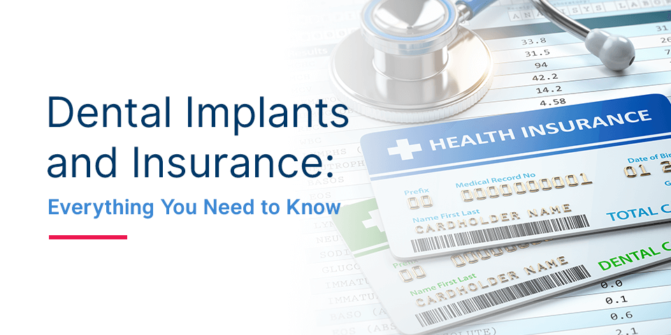 Dental insurance that covers implants