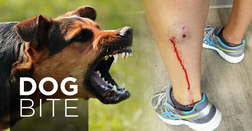 Dog bite injury lawyer